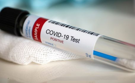 Health unit reports no new cases of COVID-19 in Grey-Bruce